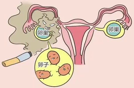 [卵巢衰退怎么治疗]