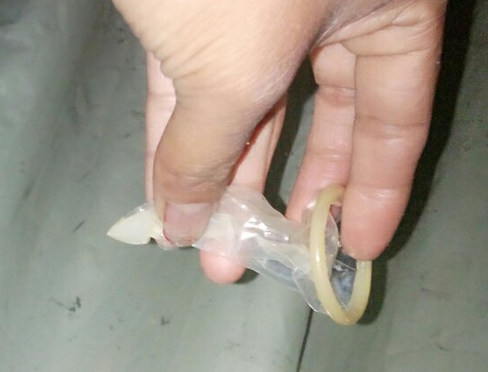精子射出的少会影响受孕吗?精子少就是“不行”？