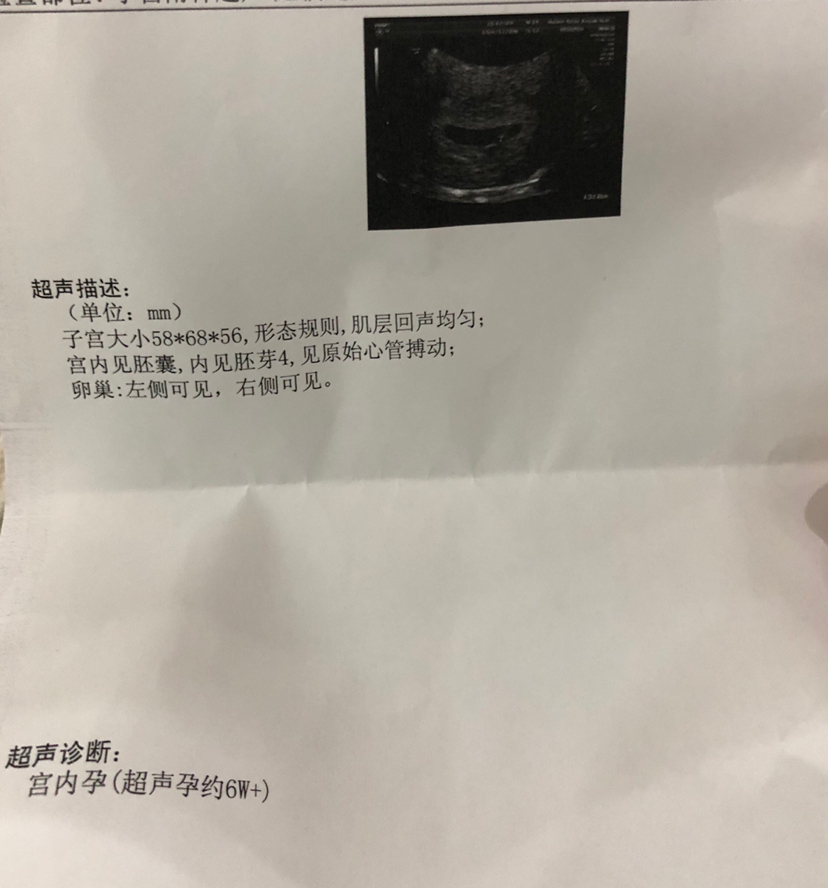 试管婴儿图片