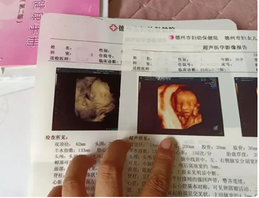 胎心率看男女不准确