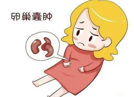 卵巢囊肿多久会癌变.png