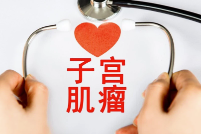子宫肌瘤的早期症状有哪些.png