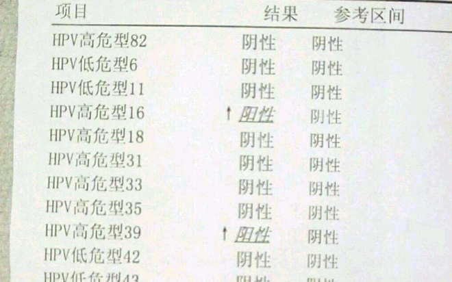 感染hpv16阳性报告