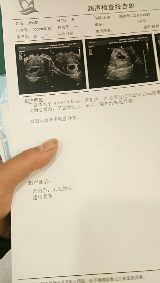 试管婴儿图片