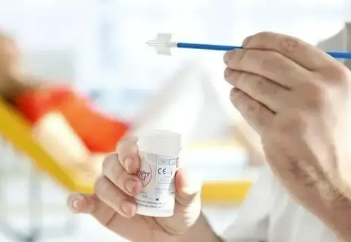 hpv检查
