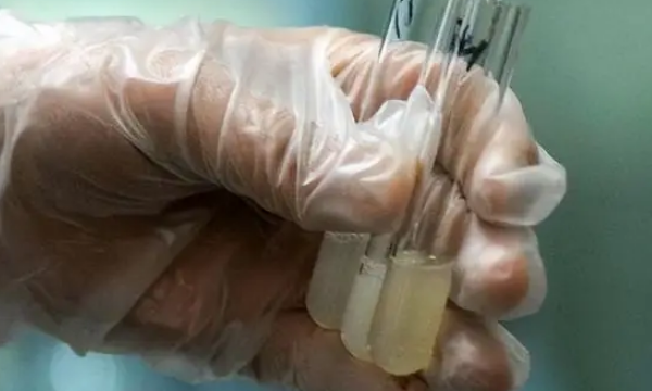 人工授精优化后精子的标准