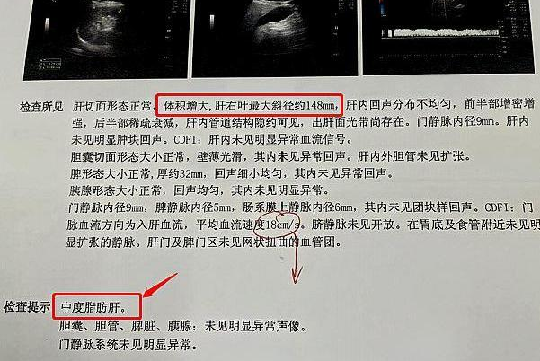 肝功能严重异常不能做试管