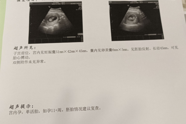 胚胎发育速度大则胎芽更大