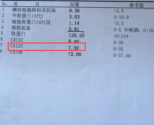 CA125异常和疾病有关