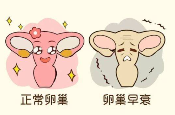 卵巢早衰影响生育能力