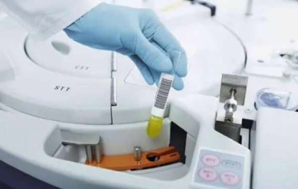 二代试管挑选精子
