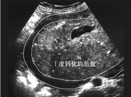 试管婴儿相关图片