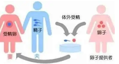 供精供卵试管婴儿合法吗.png