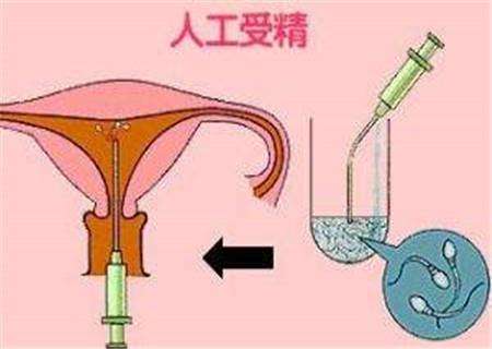 人工授精的过程
