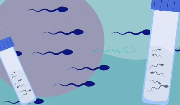 精子形态百分之三是否需要治疗