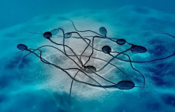 精子是否正常的判断标准