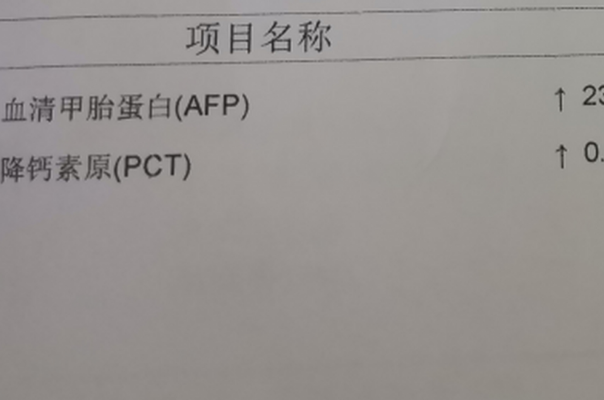 轻度肝脏疾病可做试管婴儿