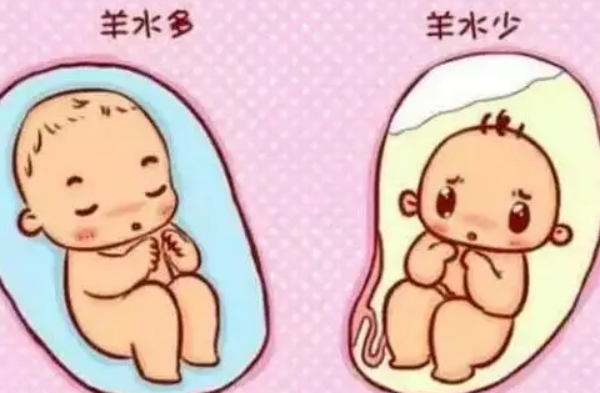 羊水多少是胎儿性别暗示