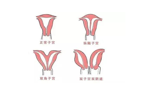 QMI5J}NV$RGF1D29Y1Q_3Q8.png