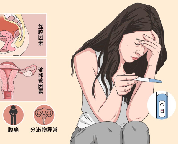 输卵管不孕可能是炎症引起