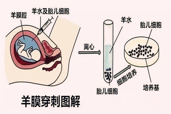 437b959470bee935a618e4e7b8d0435d823f1.png