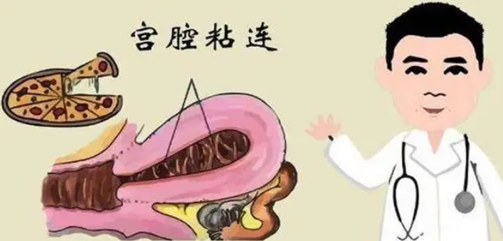 宫腔粘连.png