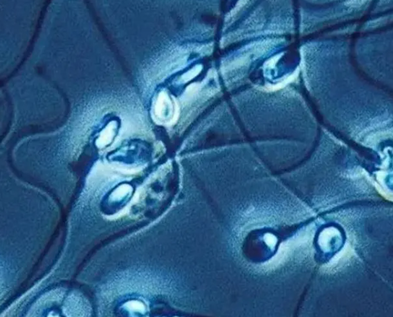 精子正常形态为2%能做二代