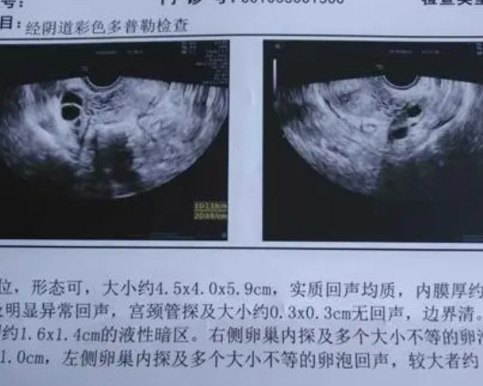 饮食健康能促进卵泡发育