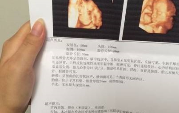 ac也就是检查胎儿腹部一周的长度