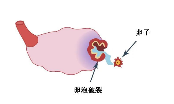 卵泡破裂同房怀孕的几率