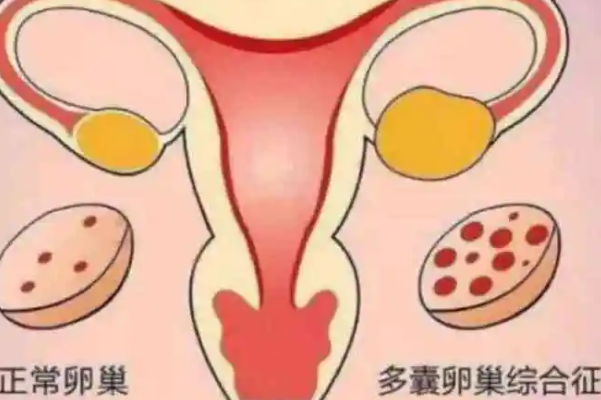子宫内膜够厚则成功率高