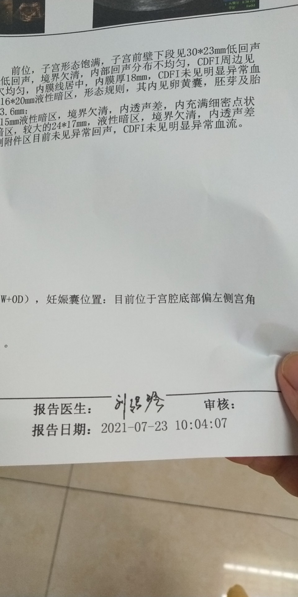 155919d3-db27-41f8-a68b-8d8dcd778ba5