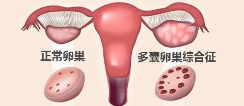 试管婴儿相关图片