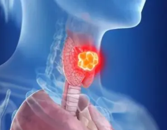 甲状腺囊肿会影响试管治疗