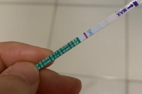 试纸过期会造成白板结果
