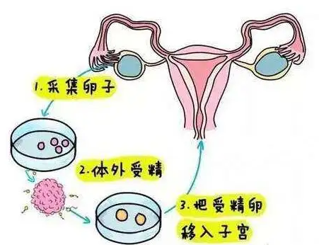 人工受精和试管的费用.png
