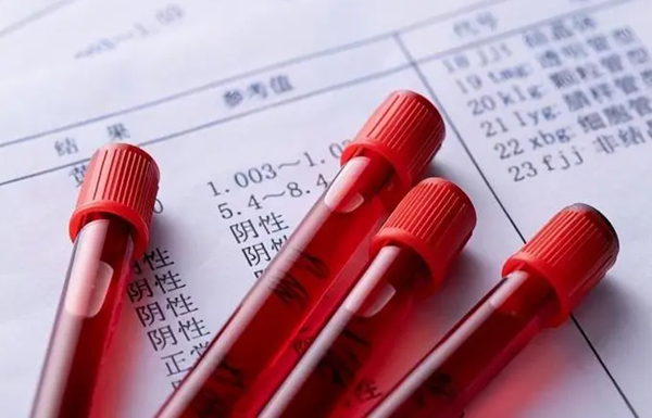 睾酮高可以促排卵看原因