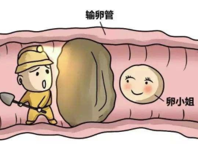 输卵管不通的治疗方法1.png