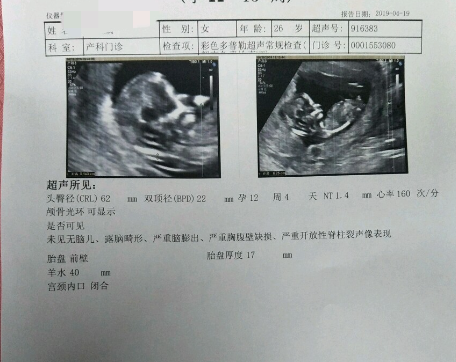 nt1.1mm是正常的