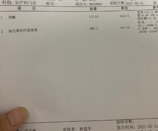 孕酮能支持受精卵发育