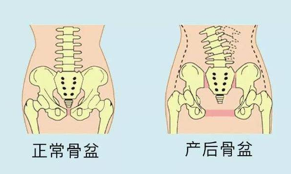 骨盆顺产的直径标准