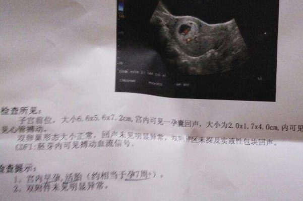 孕囊只有31mm是正常的