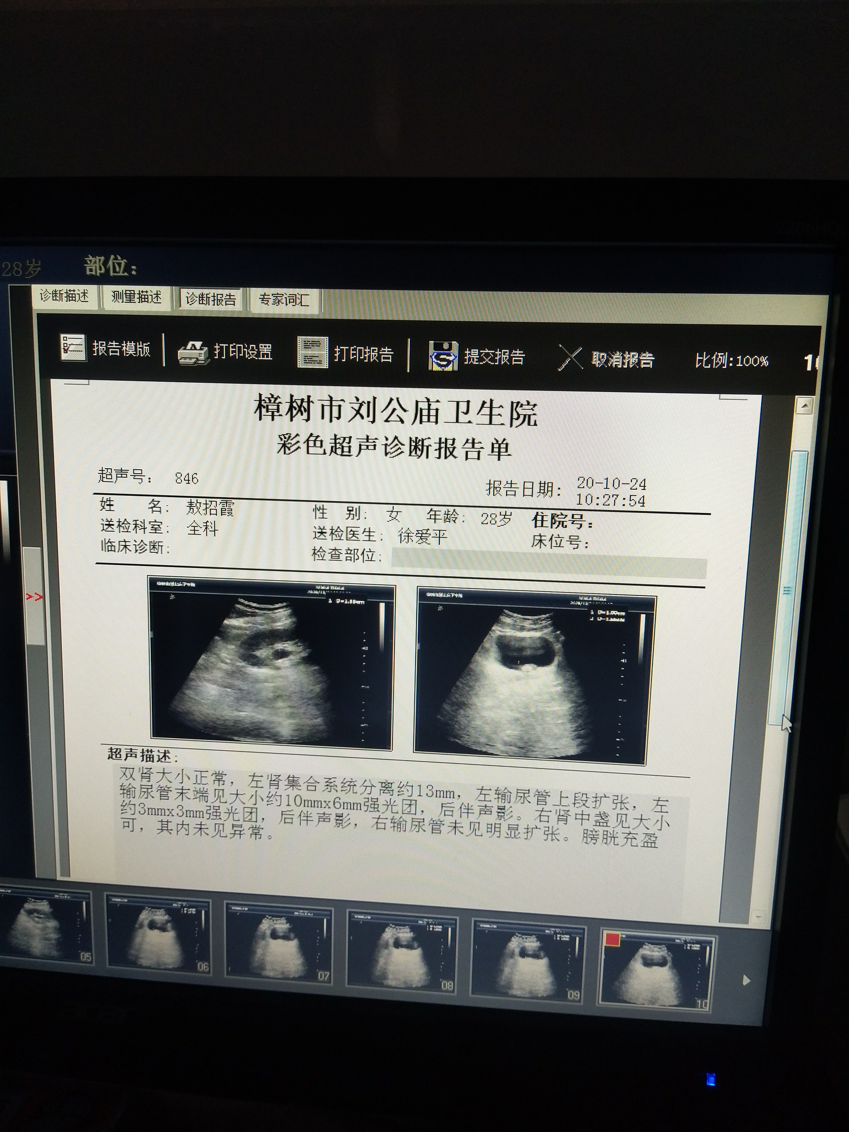 42c33abd-e651-4fb6-b10d-986456a85edb
