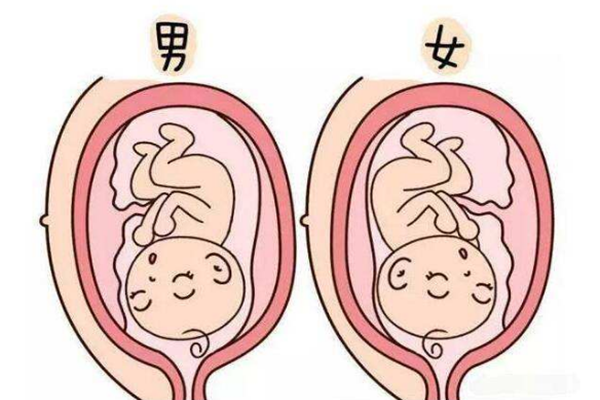 孕囊大小看男女准吗