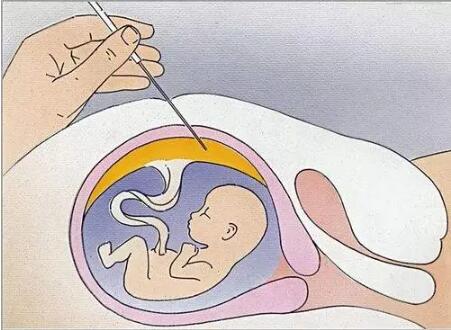 话题图标