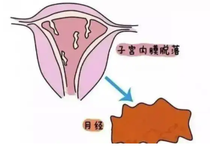 绝经后内膜多厚正常.png