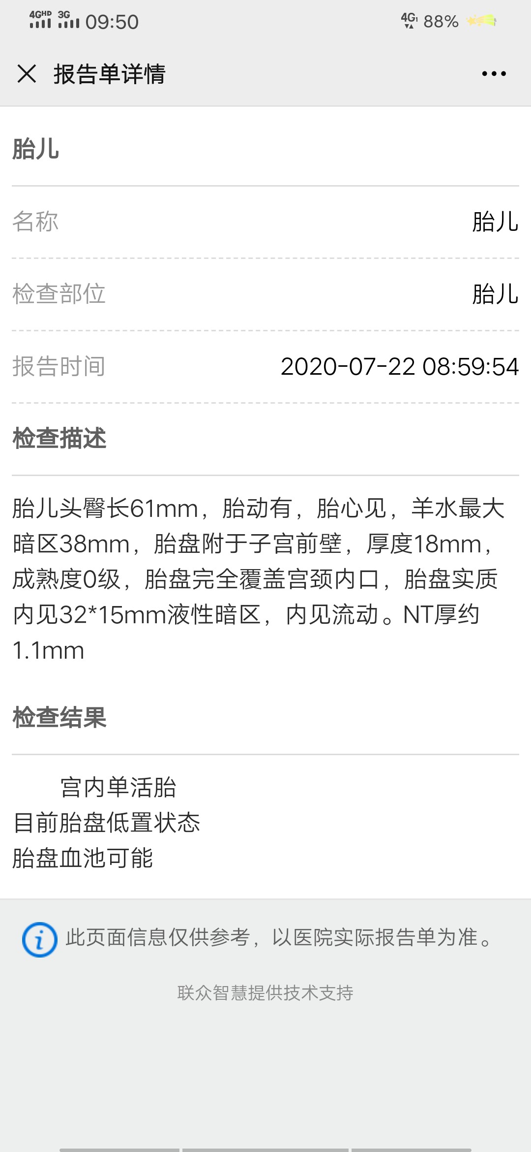 edb35ea0-2832-4700-91b4-1c9b87e2fa1d