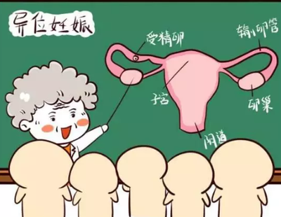 输卵管切除术后会不会宫外孕，怎么降低术后宫外孕风险
