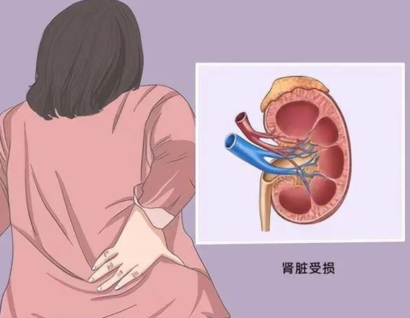 肾脏不健康会影响胚胎着床