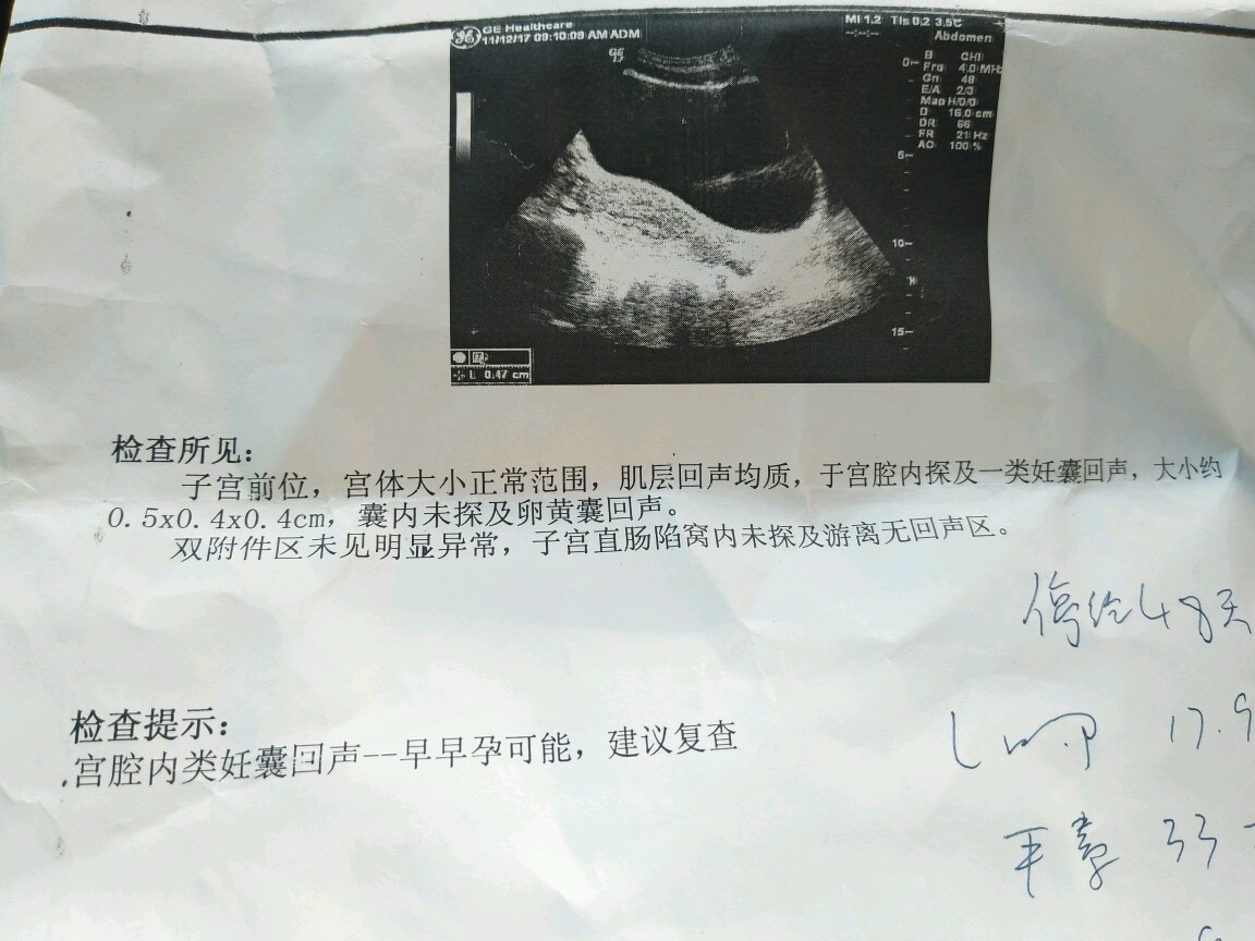 微信图片_20180223135510.jpg